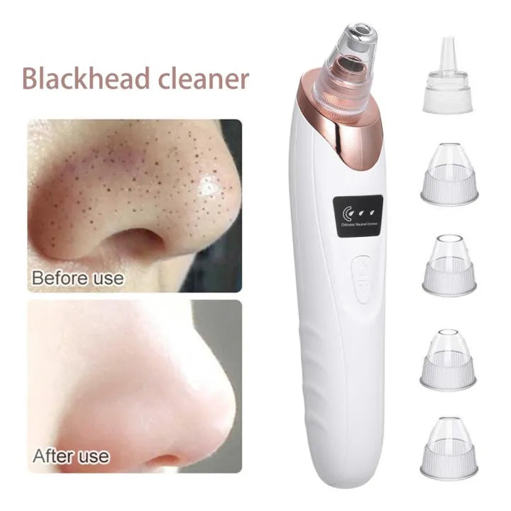 Electric Blackhead Remover 🖤✨