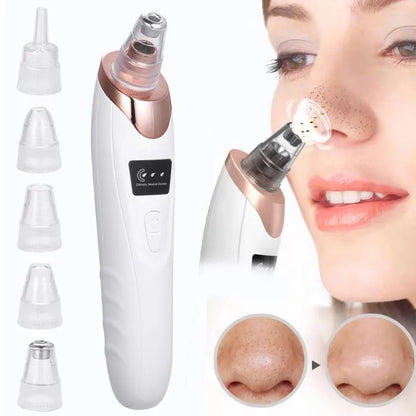 Electric Blackhead Remover 🖤✨