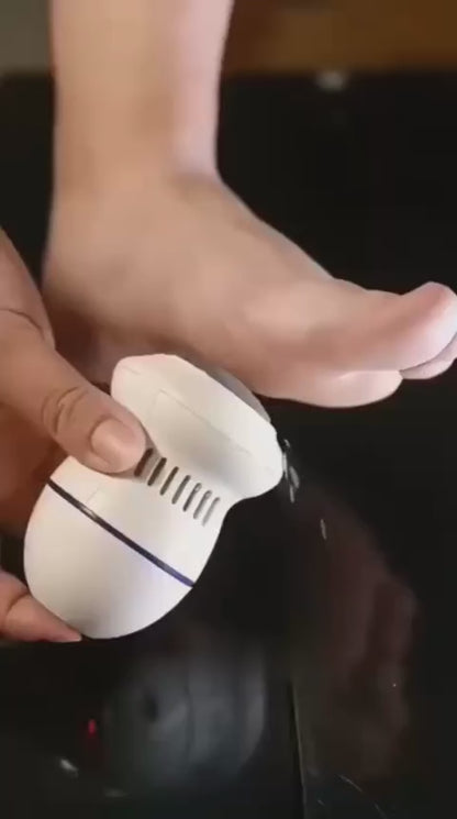 Electric Callus Remover